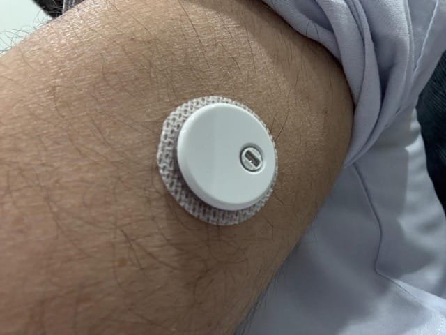 cgm device in pakistan
