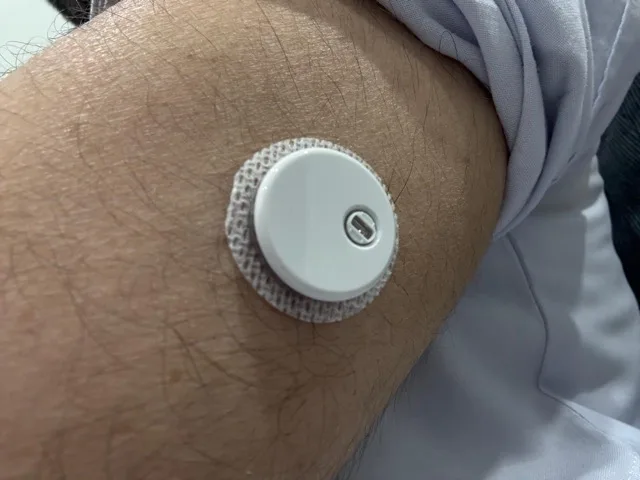 cgm device in pakistan